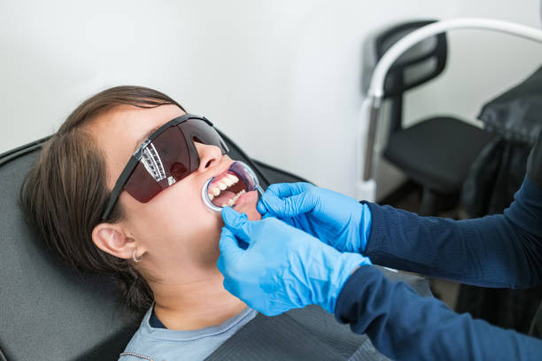 Best Emergency Wisdom Tooth Extraction in Upper Arlington, OH